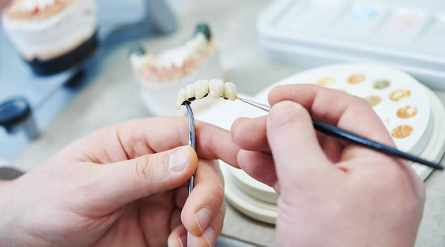 Diş protezi nasıl yapılır