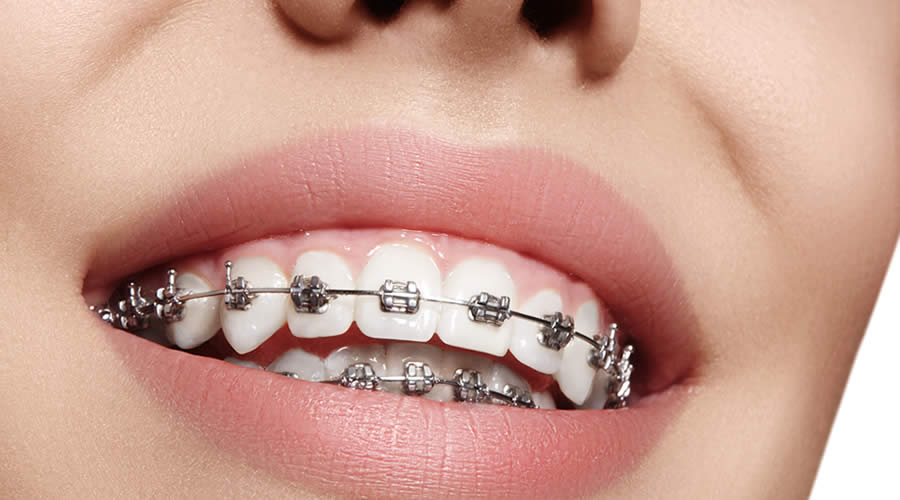 Ortodonti nedir